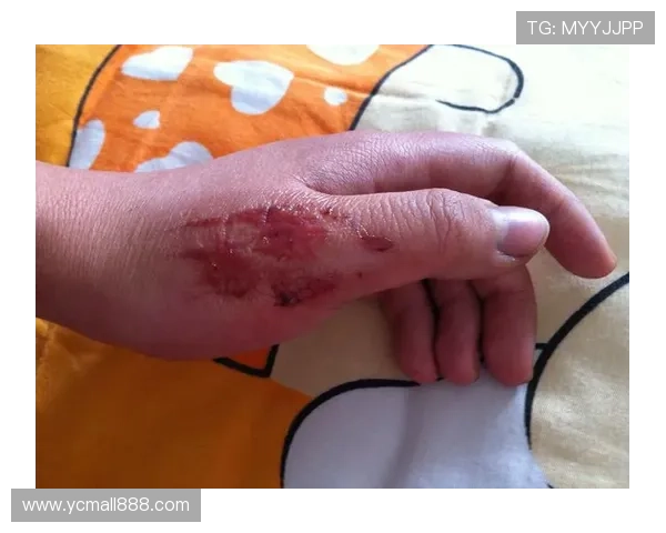 官方称鞭炮伤奥代罗球迷禁赛四